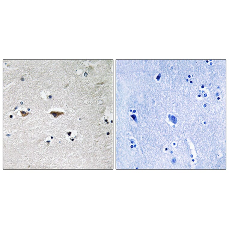 Immunohistochemistry - Anti-Src Antibody (B8186) - Antibodies.com