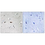 Immunohistochemistry - Anti-Src Antibody (B8186) - Antibodies.com