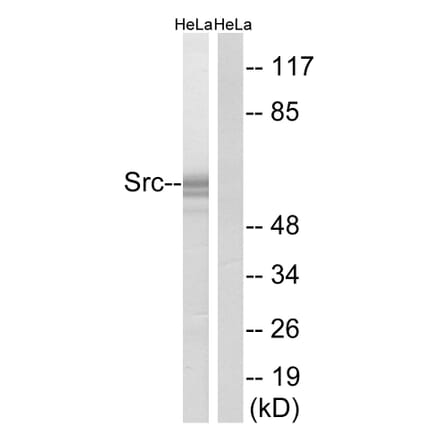 Western Blot - Anti-Src Antibody (B7220) - Antibodies.com