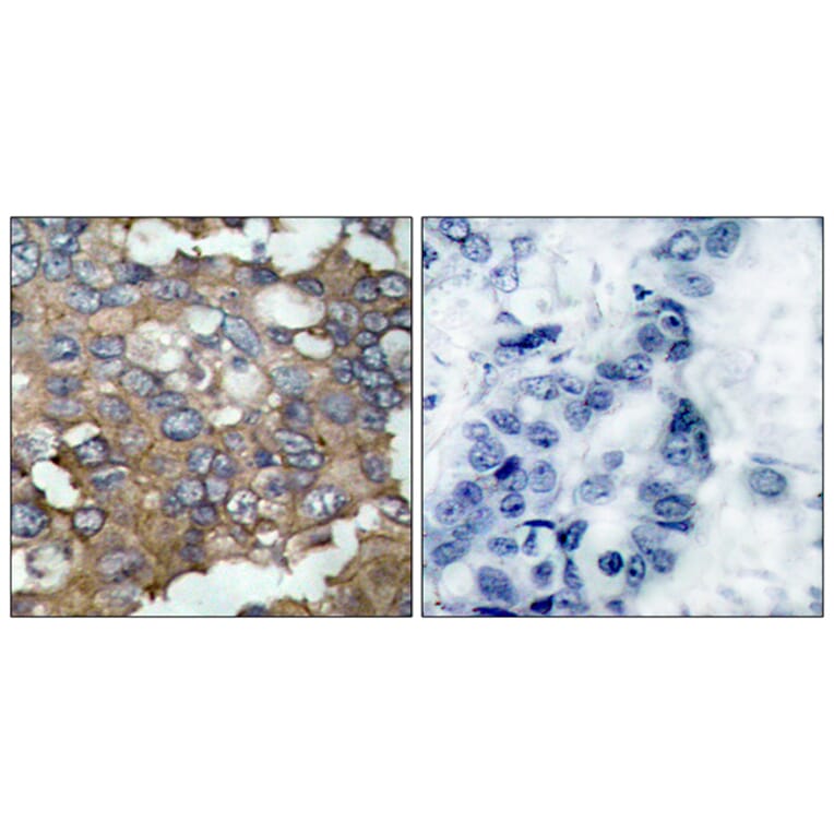 Immunohistochemistry - Anti-Src Antibody (B7220) - Antibodies.com