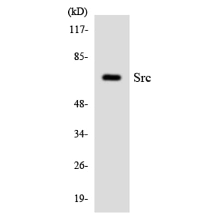 Western Blot - Anti-Src Antibody (R12-3559) - Antibodies.com