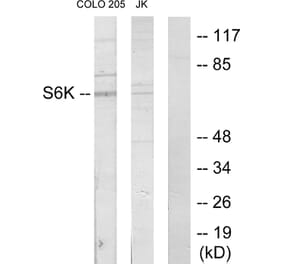 Western Blot - Anti-S6K Antibody (C10458) - Antibodies.com