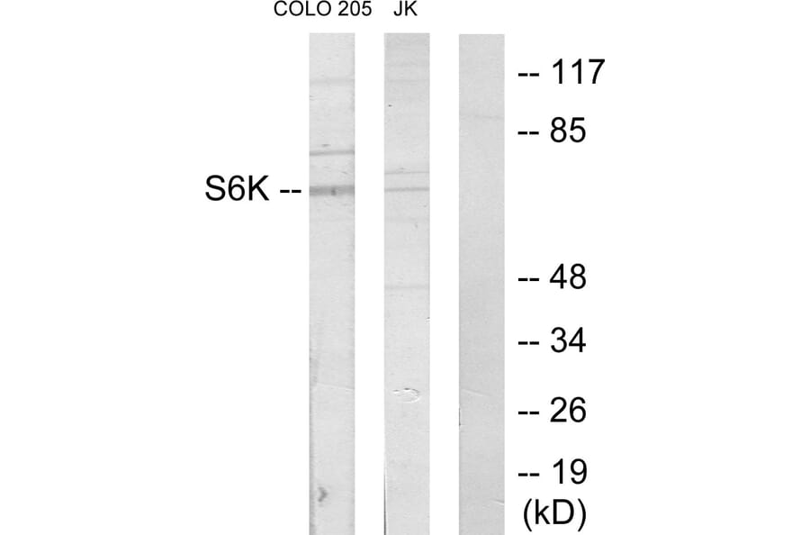 Western Blot - Anti-S6K Antibody (C10458) - Antibodies.com