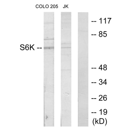 Western Blot - Anti-S6K Antibody (C10458) - Antibodies.com