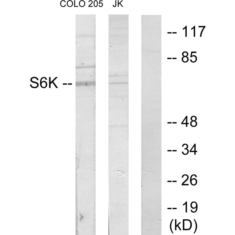 Western Blot - Anti-S6K Antibody (C10458) - Antibodies.com