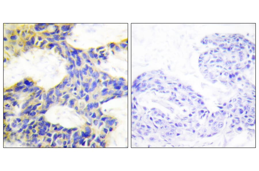 Immunohistochemistry - Anti-S6K Antibody (C10458) - Antibodies.com