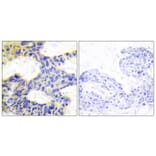 Immunohistochemistry - Anti-S6K Antibody (C10458) - Antibodies.com
