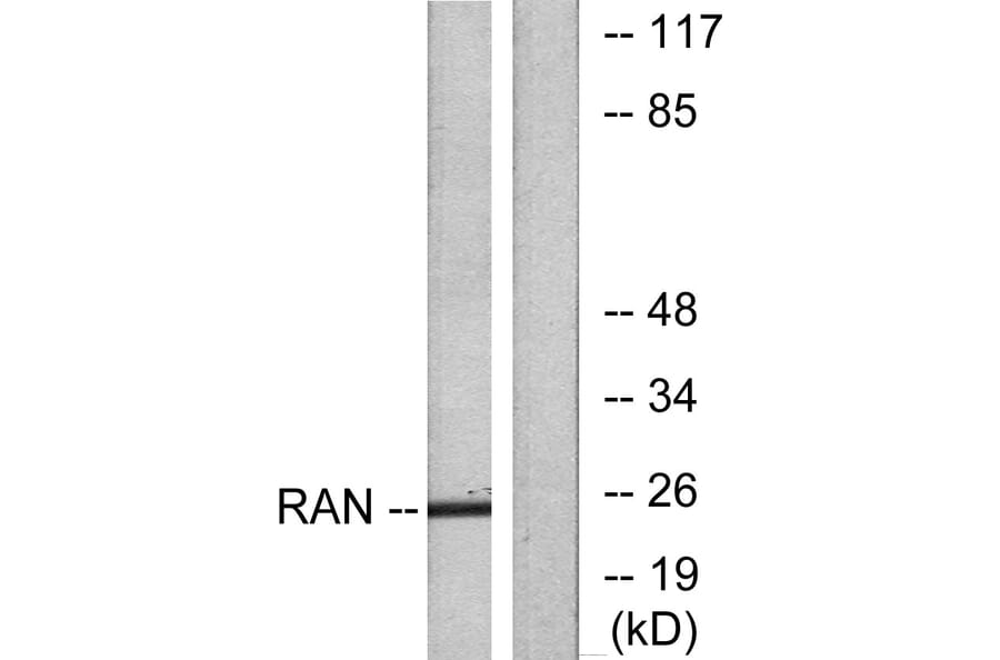 Western Blot - Anti-RAN Antibody (C0312) - Antibodies.com