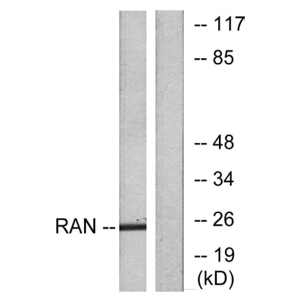 Western Blot - Anti-RAN Antibody (C0312) - Antibodies.com