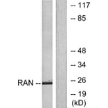 Western Blot - Anti-RAN Antibody (C0312) - Antibodies.com