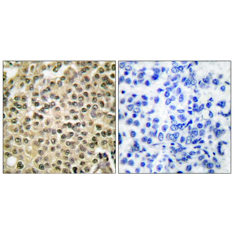 Immunohistochemistry - Anti-RAN Antibody (C0312) - Antibodies.com