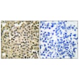 Immunohistochemistry - Anti-RAN Antibody (C0312) - Antibodies.com