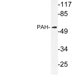 Western Blot - Anti-PAH Antibody (R12-2287) - Antibodies.com