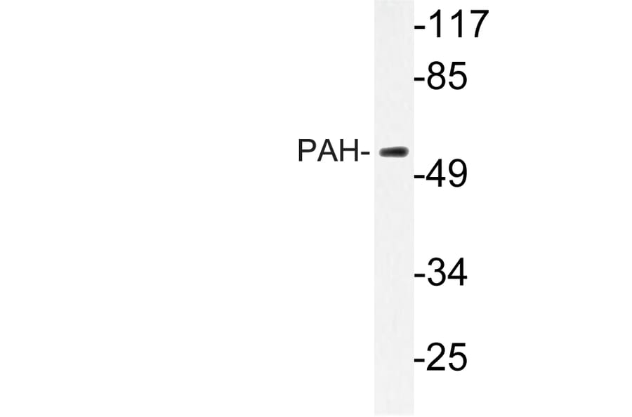 Western Blot - Anti-PAH Antibody (R12-2287) - Antibodies.com
