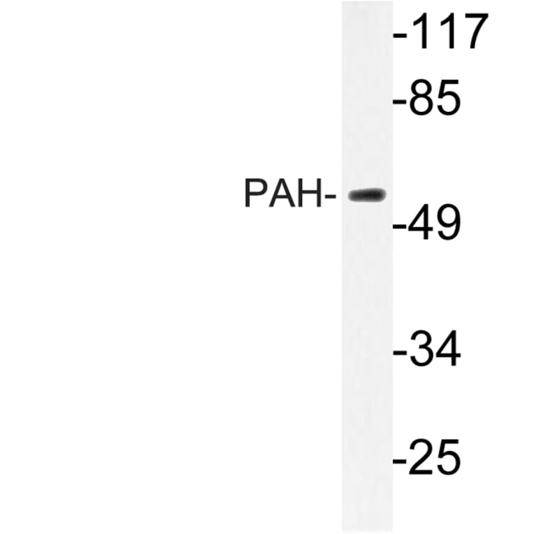 Western Blot - Anti-PAH Antibody (R12-2287) - Antibodies.com