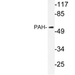 Western Blot - Anti-PAH Antibody (R12-2287) - Antibodies.com