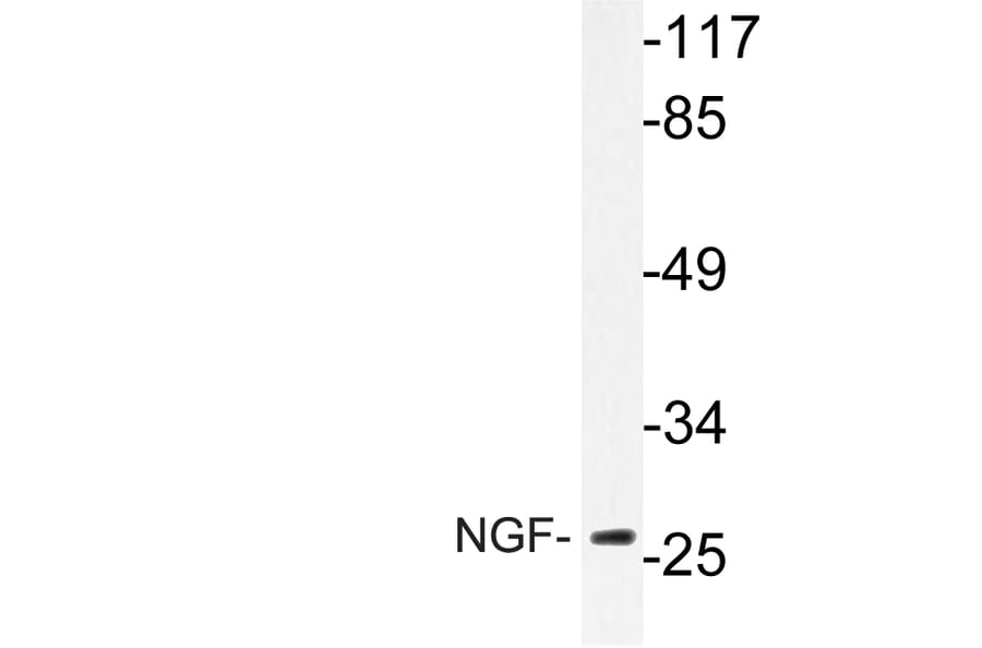 Western Blot - Anti-NGF Antibody (R12-2264) - Antibodies.com
