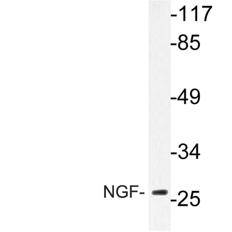 Western Blot - Anti-NGF Antibody (R12-2264) - Antibodies.com