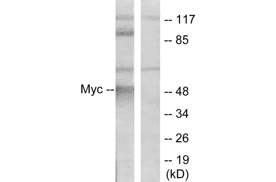 Western Blot - Anti-MYC Antibody (B7159) - Antibodies.com