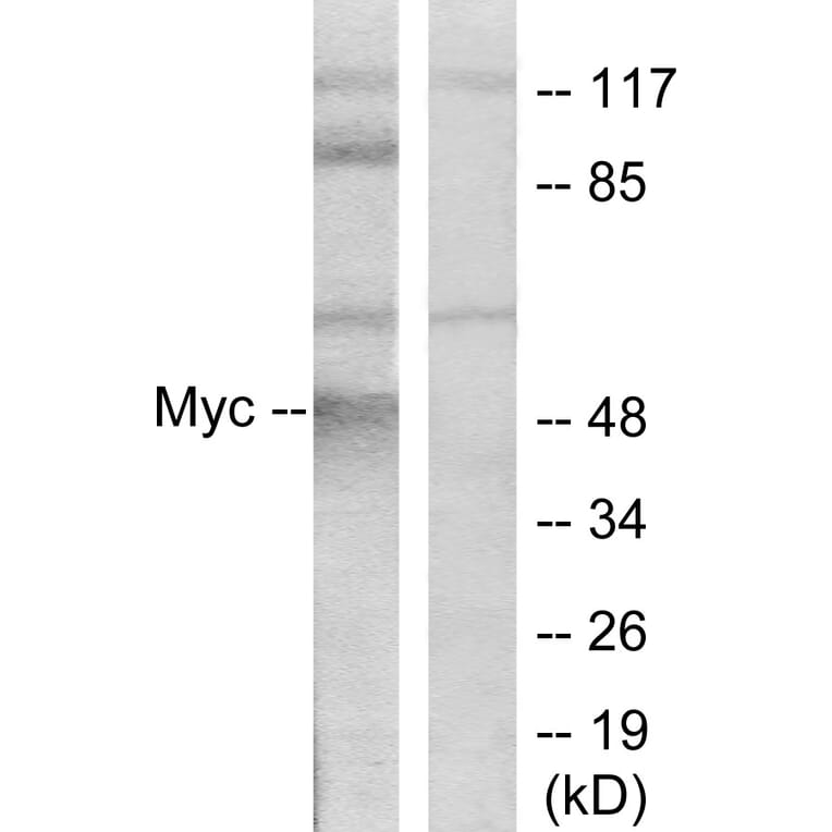 Western Blot - Anti-MYC Antibody (B7159) - Antibodies.com