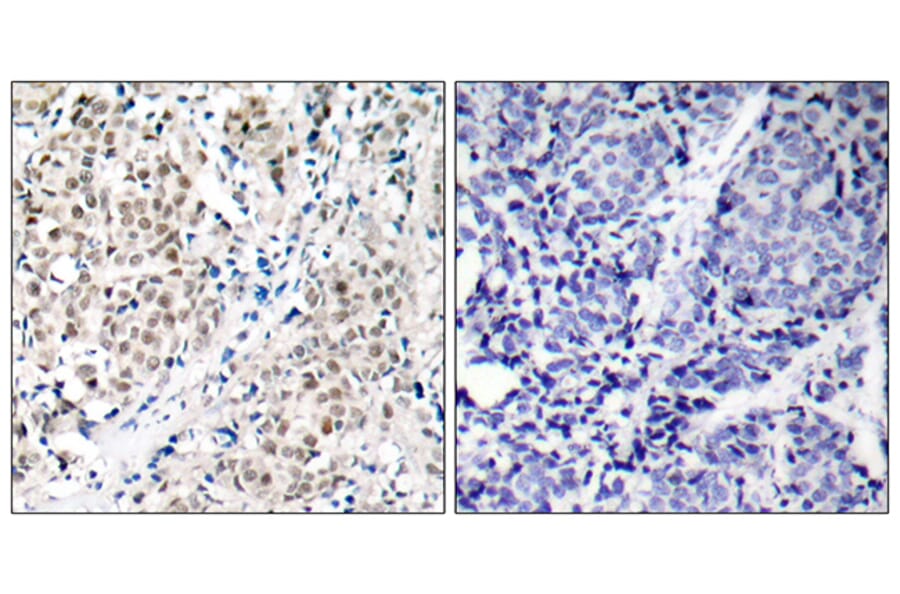 Immunohistochemistry - Anti-MYC Antibody (B7158) - Antibodies.com