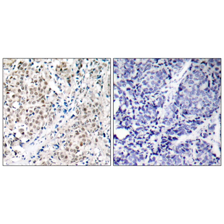 Immunohistochemistry - Anti-MYC Antibody (B7158) - Antibodies.com
