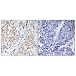 Immunohistochemistry - Anti-MYC Antibody (B7158) - Antibodies.com