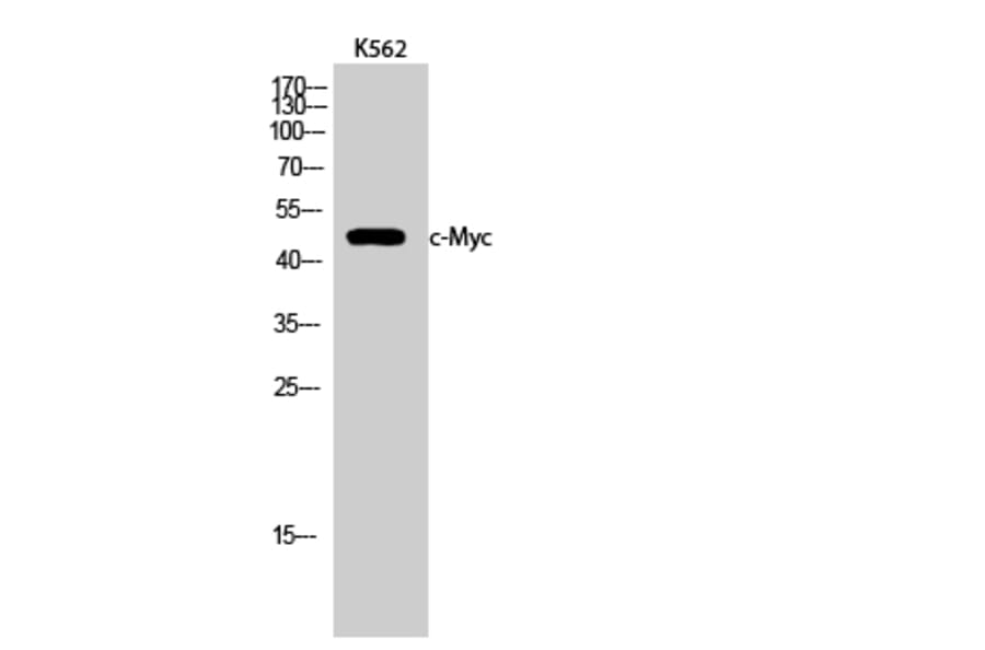 Western Blot - Anti-MYC Antibody (B7158) - Antibodies.com