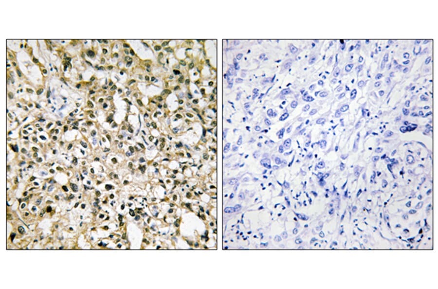 Immunohistochemistry - Anti-MYC Antibody (C10262) - Antibodies.com