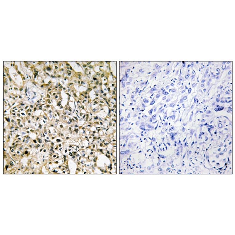 Immunohistochemistry - Anti-MYC Antibody (C10262) - Antibodies.com