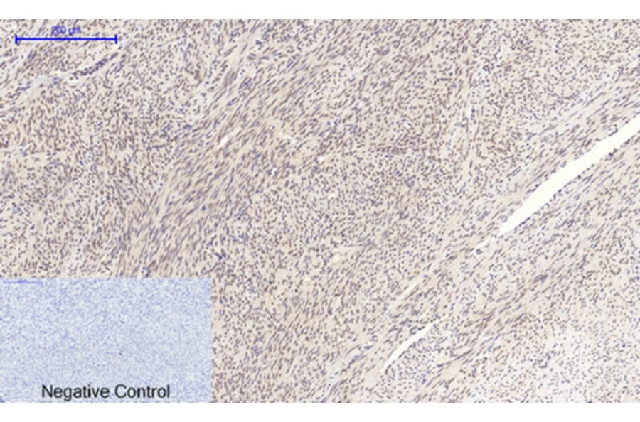 Immunohistochemistry - Anti-MYC Antibody (C10262) - Antibodies.com