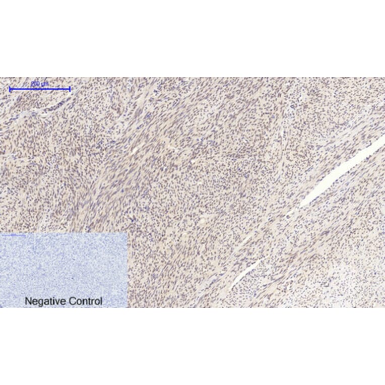 Immunohistochemistry - Anti-MYC Antibody (C10262) - Antibodies.com