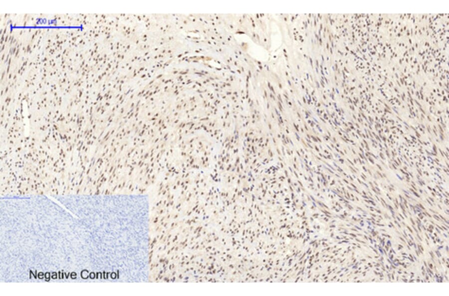 Immunohistochemistry - Anti-MYC Antibody (C10262) - Antibodies.com