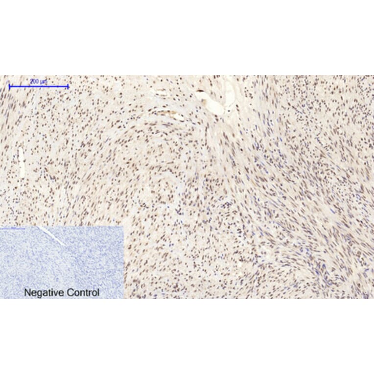 Immunohistochemistry - Anti-MYC Antibody (C10262) - Antibodies.com