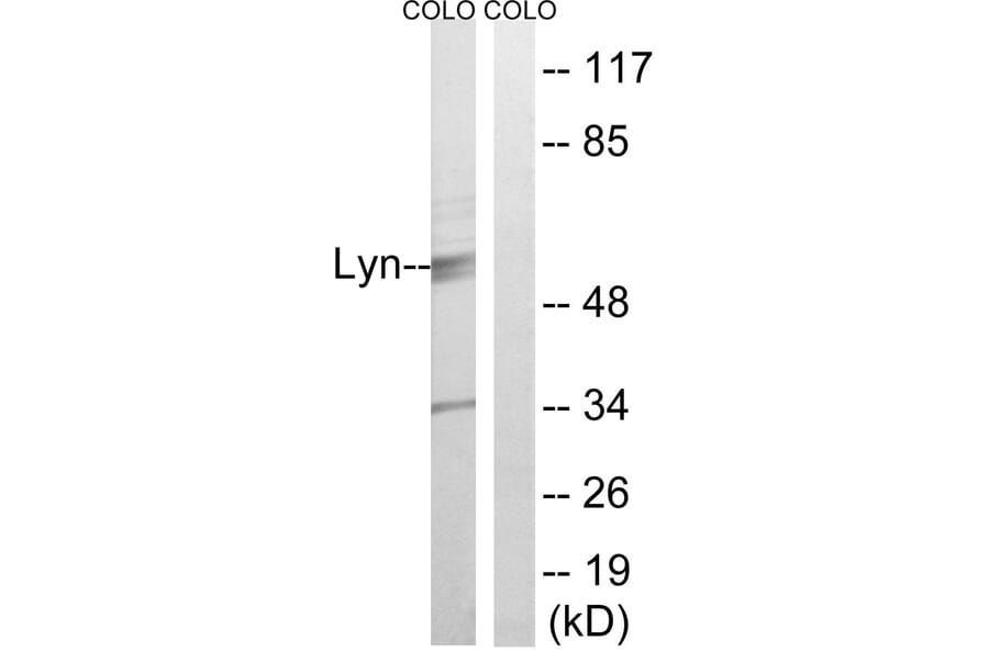 Western Blot - Anti-Lyn Antibody (B0076) - Antibodies.com