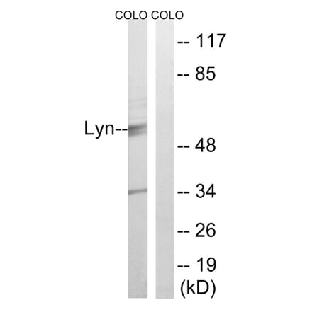 Western Blot - Anti-Lyn Antibody (B0076) - Antibodies.com