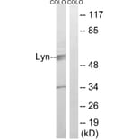 Western Blot - Anti-Lyn Antibody (B0076) - Antibodies.com