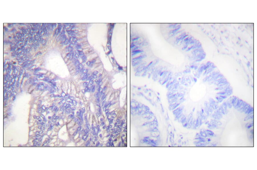 Immunohistochemistry - Anti-Lyn Antibody (B0076) - Antibodies.com