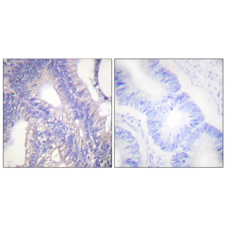 Immunohistochemistry - Anti-Lyn Antibody (B0076) - Antibodies.com