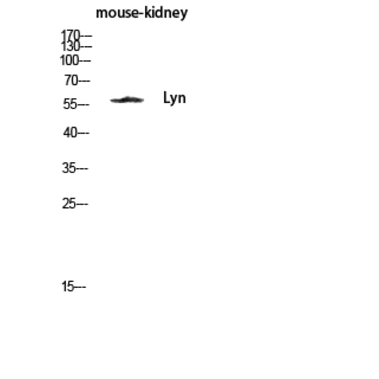 Western Blot - Anti-Lyn Antibody (B0076) - Antibodies.com