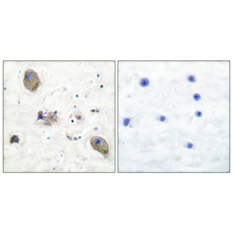 Immunohistochemistry - Anti-Lyn Antibody (B0076) - Antibodies.com
