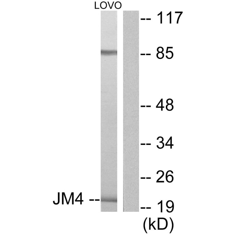 Western Blot - Anti-JM4 Antibody (C0238) - Antibodies.com