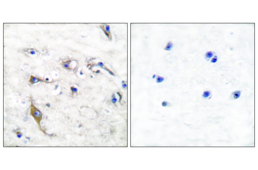 Immunohistochemistry - Anti-JM4 Antibody (C0238) - Antibodies.com