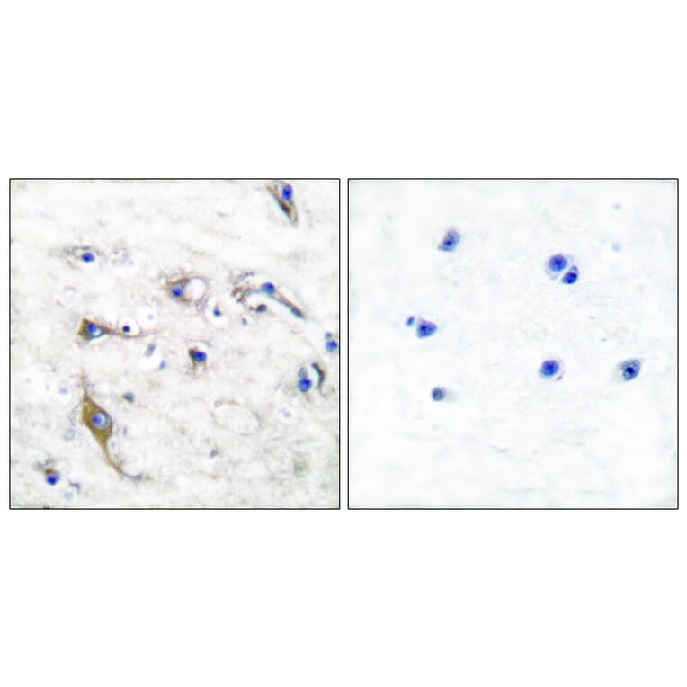 Immunohistochemistry - Anti-JM4 Antibody (C0238) - Antibodies.com