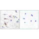 Immunohistochemistry - Anti-JM4 Antibody (C0238) - Antibodies.com