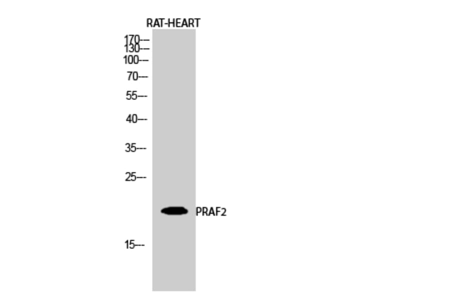 Western Blot - Anti-JM4 Antibody (C0238) - Antibodies.com