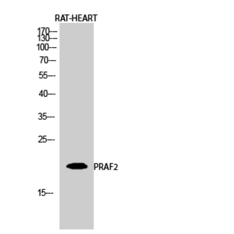 Western Blot - Anti-JM4 Antibody (C0238) - Antibodies.com