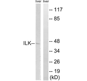 Western Blot - Anti-ILK Antibody (B8115) - Antibodies.com