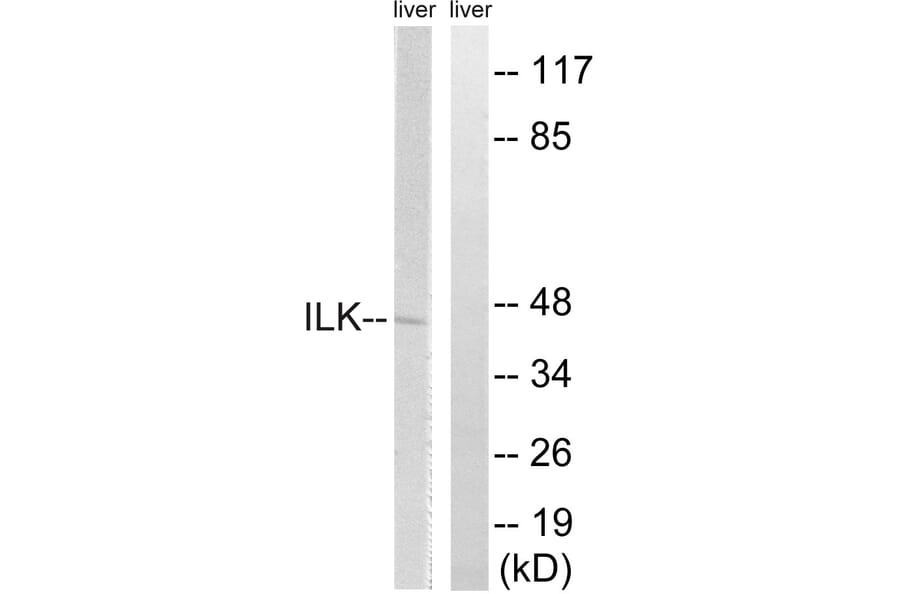 Western Blot - Anti-ILK Antibody (B8115) - Antibodies.com