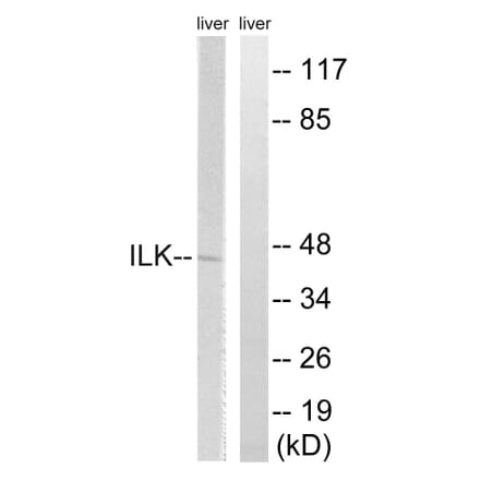 Western Blot - Anti-ILK Antibody (B8115) - Antibodies.com